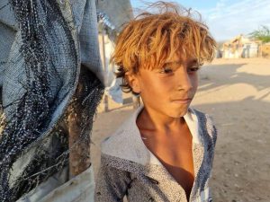 بیماری های واگیردار در یمن